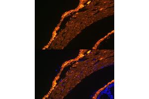 anti-Actin, alpha 2, Smooth Muscle, Aorta (ACTA2) antibody
