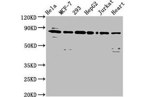 Western Blot Positive WB detected in: Hela whole cell lysate, MCF-7 whole cell lysate, 293 whole cell lysate, HepG2 whole cell lysate, Jurkat whole cell lysate, Mouse heart tissue All lanes: LETM1 antibody at 6. (LETM1 anticorps  (AA 443-543))