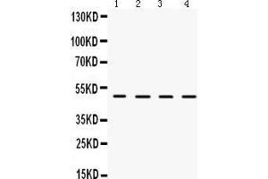 Western Blotting (WB) image for anti-Lecithin-Cholesterol Acyltransferase (LCAT) (AA 389-423), (C-Term) antibody (ABIN3043289)