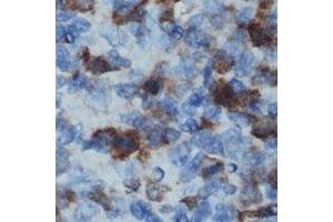 Immunohistochemical analysis of CD32b staining in human lymph node formalin fixed paraffin embedded tissue section. (FCGR2B anticorps  (C-Term))
