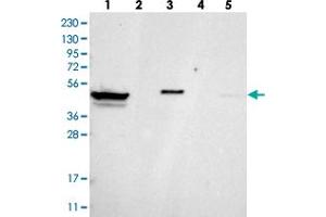 Western blot analysis of Lane 1: RT-4, Lane 2: U-251 MG, Lane 3: Human Plasma, Lane 4: Liver, Lane 5: Tonsil with ZNF774 polyclonal antibody . (ZNF774 anticorps)
