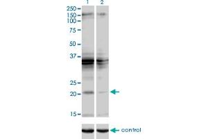 Western blot analysis of SCAND2 over-expressed 293 cell line, cotransfected with SCAND2 Validated Chimera RNAi (Lane 2) or non-transfected control (Lane 1). (SCAND2 anticorps  (AA 1-62))