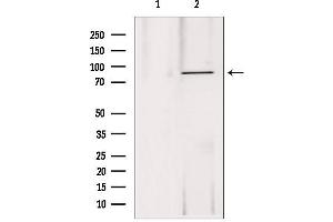 Western blot analysis of extracts from 293, using DDX21 antibody. (DDX21 anticorps  (Internal Region))
