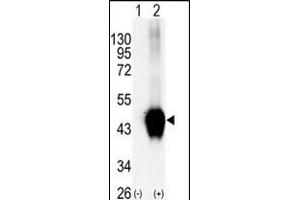 Western blot analysis of BCKDK (arrow) using rabbit polyclonal BCKDK Antibody (C-term ) (R). (BCKDK anticorps  (C-Term))
