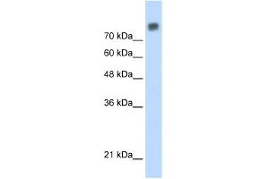WB Suggested Anti-MCM6 Antibody Titration:  0. (MCM6 anticorps  (C-Term))