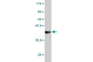 Western Blot detection against Immunogen (36. (RAB9A anticorps  (AA 17-115))