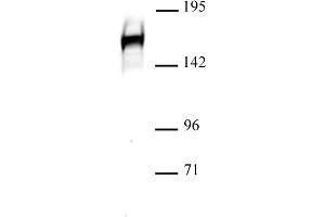 DROSHA anticorps  (C-Term)