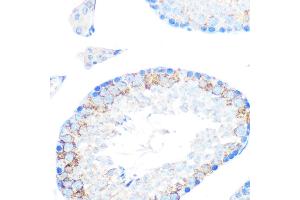Immunohistochemistry of paraffin-embedded mouse testis using MSR1 Rabbit mAb (ABIN7268353) at dilution of 1:100 (40x lens). (Macrophage Scavenger Receptor 1 anticorps)
