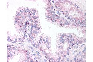 Anti-ERG antibody IHC of human prostate. (ERG anticorps  (AA 469-481))