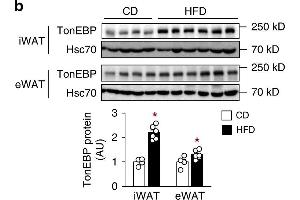 Adipocyte TonEBP expression is elevated in obesity and TonEBP-deficient mice resist obesity.