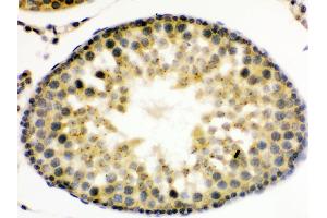Anti- UPF3B/RENT3B Picoband antibody, IHC(P) IHC(P): Rat Testis Tissue