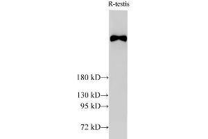 Western Blot analysis of Rat testis using BRCA2 Polyclonal Antibody at dilution of 1:2000