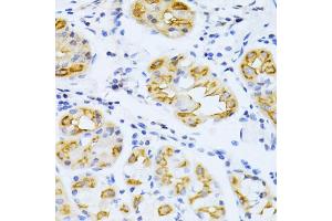 Immunohistochemistry of paraffin-embedded human stomach using CYP2E1 antibody (ABIN5971187) at dilution of 1/100 (40x lens). (CYP2E1 anticorps)