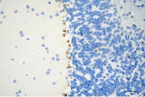 Immunohistochemistry was performed on paraffin-embedded mouse brain using SOX9 antibody (ABIN7800973), 1:200). (Recombinant SRY-Box Transcription Factor 9 anticorps)