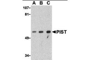 Western Blotting (WB) image for anti-Golgi-Associated PDZ and Coiled-Coil Motif Containing (GOPC) (Middle Region) antibody (ABIN1031039)