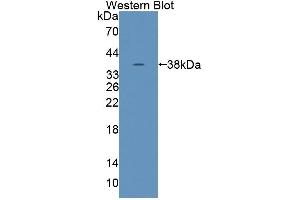 Western blot analysis of the recombinant protein. (Tensin 1 anticorps  (AA 4-307))