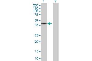 Western Blot analysis of RNF113B expression in transfected 293T cell line by RNF113B MaxPab polyclonal antibody. (RNF113B anticorps  (AA 1-322))