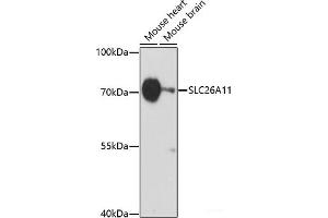Western blot analysis of extracts of various cell lines using SLC26A11 Polyclonal Antibody at dilution of 1:1000. (SLC26A11 anticorps)