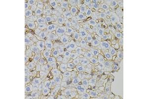 Immunohistochemistry of paraffin-embedded mouse liver using CLDN3 antibody.