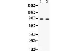 Western Blotting (WB) image for anti-Polo-Like Kinase 1 (PLK1) (AA 86-430) antibody (ABIN3043354) (PLK1 anticorps  (AA 86-430))