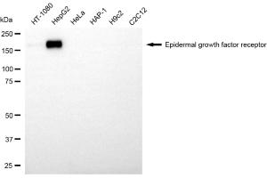 Western blotting analysis using epidermal growth factor receptor antibody (ABIN7798472).