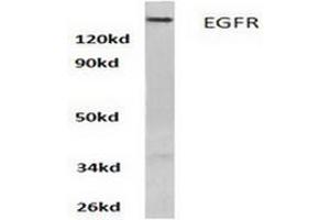 Image no. 1 for anti-Epidermal Growth Factor Receptor (EGFR) antibody (ABIN265397) (EGFR anticorps)