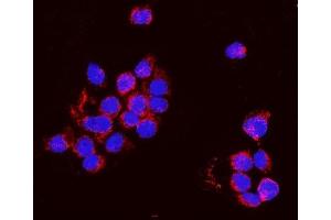 IF analysis of PNPT1 using anti-PNPT1 antibody (ABIN7599172).
