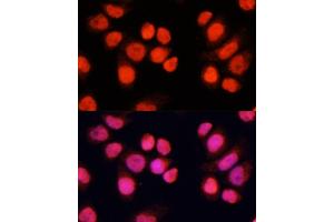 Immunofluorescence analysis of Hela cells using CH antibody (ABIN6127698, ABIN6138485, ABIN6138486 and ABIN6215383) at dilution of 1:100 (40x lens). (ZNF828 anticorps  (AA 563-812))