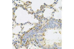 Immunohistochemistry of paraffin-embedded rat lung using UBE2B Antibody. (UBE2B anticorps  (AA 1-152))