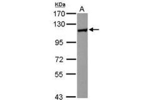 Image no. 2 for anti-Huntingtin Interacting Protein 1 Related (HIP1R) (N-Term) antibody (ABIN1494032) (HIP1R anticorps  (N-Term))