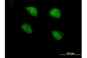 Immunofluorescence of purified MaxPab antibody to PPP2R3B on HeLa cell. (PPP2R3B anticorps  (AA 1-176))