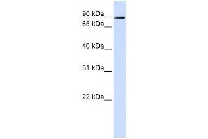 Western Blotting (WB) image for anti-Anoctamin 10 (ANO10) antibody (ABIN2459104) (Anoctamin 10 anticorps)