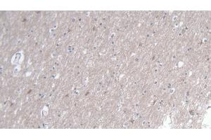 Detection of TIRAP in Human Cerebrum Tissue using Polyclonal Antibody to Toll Interleukin 1 Receptor Domain Containing Adaptor Protein (TIRAP)