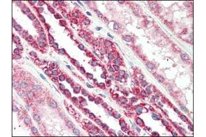 Human Kidney (formalin-fixed, paraffin-embedded) stained with TSPOat 2. (TSPO anticorps  (C-Term))