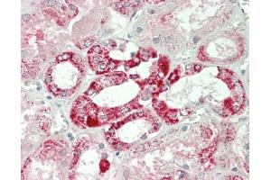 Human Kidney: Formalin-Fixed, Paraffin-Embedded (FFPE).