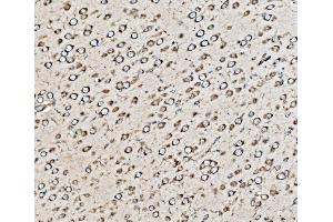 IHC analysis of Kinectin 1/KTN1 using anti-Kinectin 1/KTN1 antibody (ABIN7601096). (KTN1 anticorps  (AA 283-827))