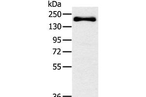 Western Blot analysis of Mouse bladder tissue using SLIT2 Polyclonal Antibody at dilution of 1:200 (SLIT2 anticorps)