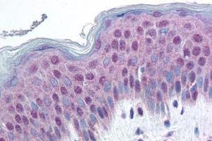 Human Skin (formalin-fixed, paraffin-embedded) stained with HMGN1 antibody ABIN214463 at 20 ug/ml followed by biotinylated goat anti-rabbit IgG secondary antibody ABIN481713, alkaline phosphatase-streptavidin and chromogen.