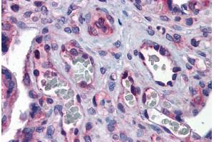 Human Placenta: Formalin-Fixed, Paraffin-Embedded (FFPE)