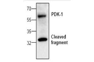 Image no. 1 for anti-3-phosphoinositide Dependent Protein Kinase-1 (PDPK1) antibody (ABIN127128) (PDPK1 anticorps)