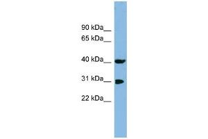 WB Suggested Anti-PPID Antibody Titration: 0. (PPID anticorps  (N-Term))