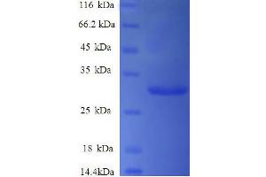 SDS-PAGE (SDS) image for Synuclein, gamma (Breast Cancer-Specific Protein 1) (SNCG) (AA 1-127), (full length) protein (His-SUMO Tag) (ABIN5710388)