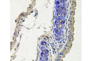 Immunohistochemistry of paraffin-embedded Mouse lung using SKP1 Polyclonal Antibody at dilution of 1:100 (40x lens). (SKP1 anticorps)