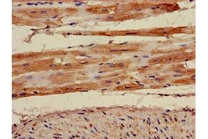 Immunohistochemistry of paraffin-embedded human heart tissue using ABIN7142910 at dilution of 1:100 (AKAP7 anticorps  (AA 1-81))