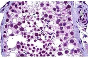 Human Testis: Formalin-Fixed, Paraffin-Embedded (FFPE) (WT1 anticorps  (AA 349-439))