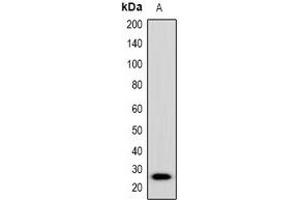 Western blot analysis of Placental Lactogen expression in mouse brain (A) whole cell lysates.