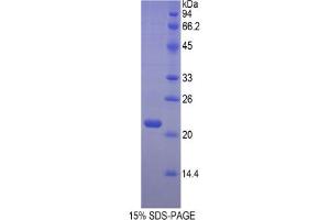 SDS-PAGE analysis of Mouse Hemoglobin beta Protein. (Hemoglobin Subunit beta Protéine)