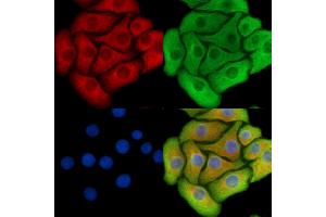 ABIN6260715 and ABIN6278829 staining Hela cells by IF/ICC. (CDK5RAP1 anticorps  (C-Term))