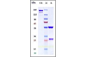 Anti-ALCAM / CD166 Reference Antibody (AT002) on SDS-PAGE under reducing (R) condition.