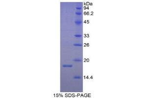 SDS-PAGE (SDS) image for Retinol Binding Protein 1, Cellular (RBP1) (AA 1-135) protein (His tag) (ABIN1879322)